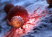 Cancer2