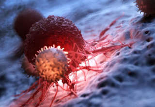 Cancer2
