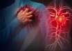 Homme crise cardiaque coeur